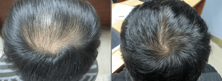 Revitalizing Hair Growth Serum for Thinning Hair 5
