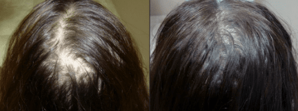 Revitalizing Hair Growth Serum for Thinning Hair 6