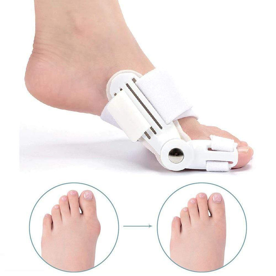 Adjustable Orthopedic Bunion Corrector for Pain Relief and Toe Alignment (1 Pair) 1