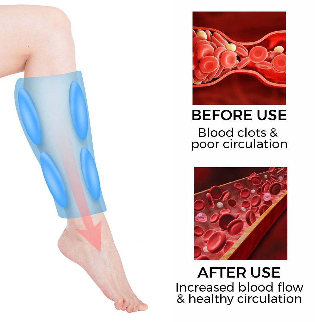 מסאז'ר רגליים אלחוטי עם דחיסת אוויר ארופלקס לשימוש ביתי ולטיולים